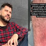 Jornalista Evaristo Costa e imagem de sua perna que ele divulgou nas redes sociais ao falar de erisipela e celulite