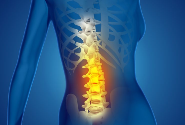Imagem 3D da coluna humana em destaque para falar sobre dor lombar
