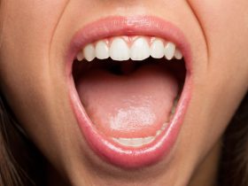 Boca de uma pessoa aberta mostrando os dentes e a língua