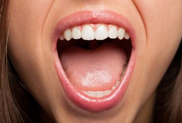 Boca de uma pessoa aberta mostrando os dentes e a língua