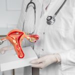 Médica ginecologista segurando um modelo de útero
