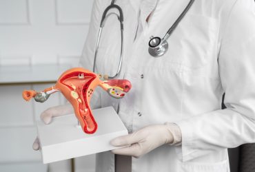 Médica ginecologista segurando um modelo de útero