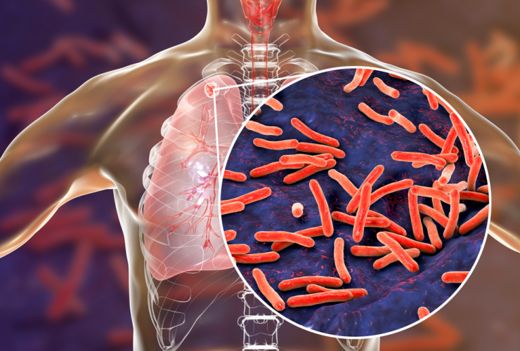 A bactéria Mycobacterium tuberculosis