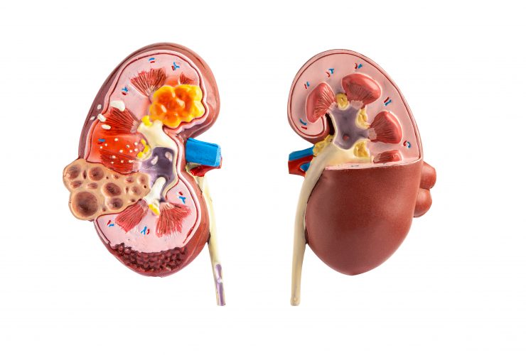 Doença renal, doença renal crônica ckd, modelo para estudo isolado em fundo branco. Por chormail