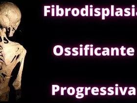 Doença Fibrodisplasia Ossificante Progressiva