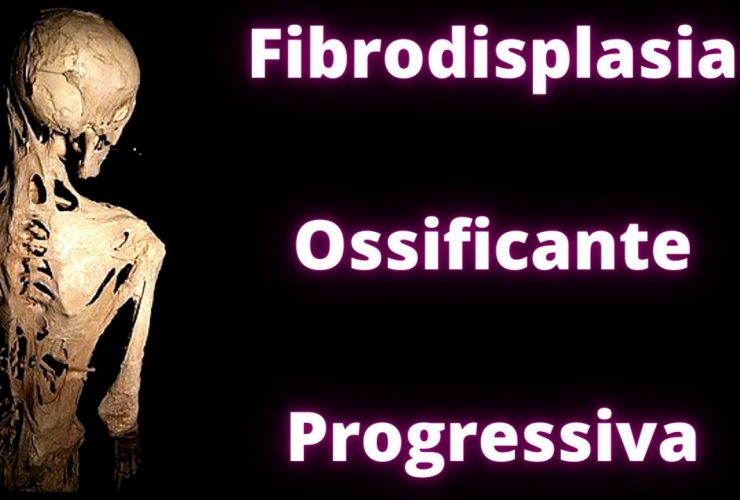 Doença Fibrodisplasia Ossificante Progressiva