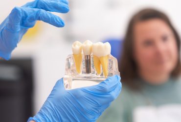 Close-up do modelo dentário com implante. paciente de clínica odontológica em fundo desfocado. odontologia Por demopicture